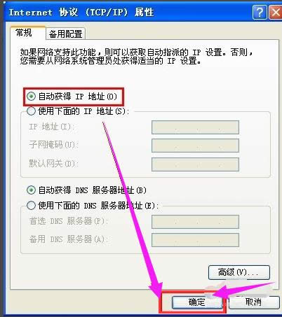 本地连接