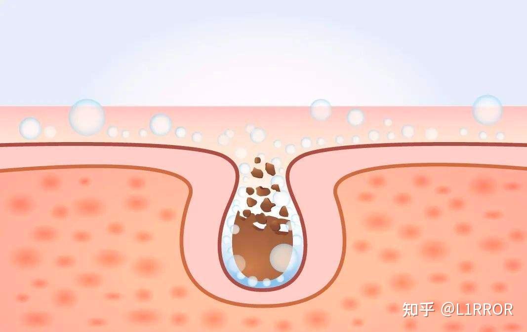 刷酸攻略_刷关键词快速排名软件_刷酸方法